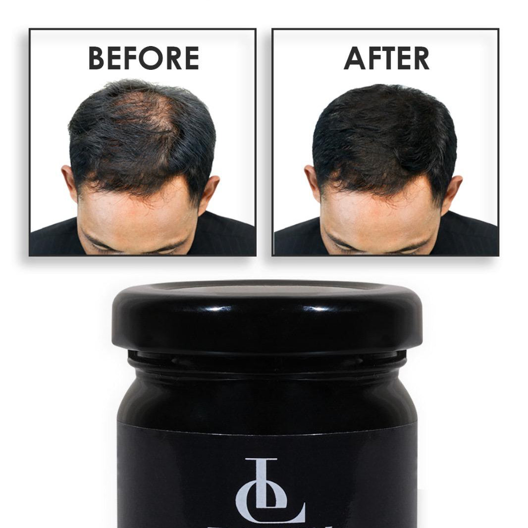 Dermavol saç kapatıcı krem