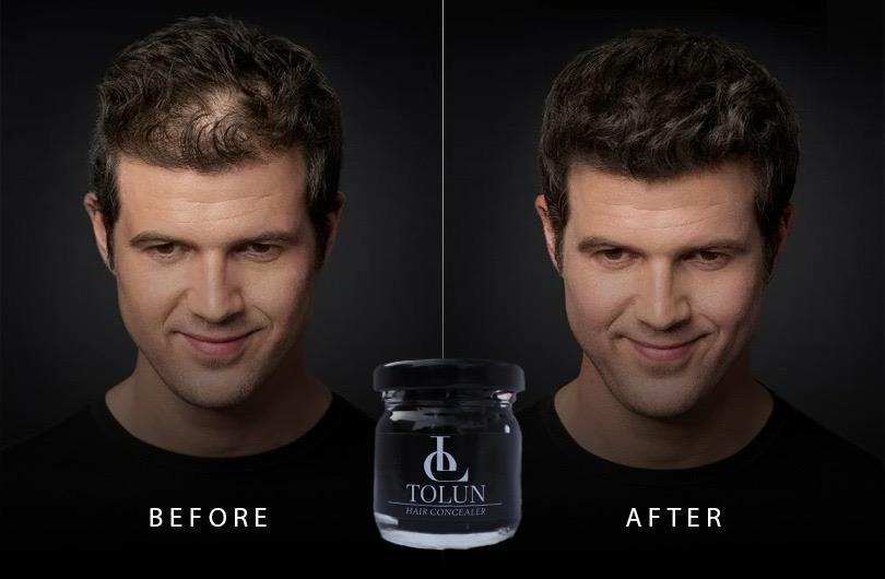 Dermavol saç kapatıcı krem