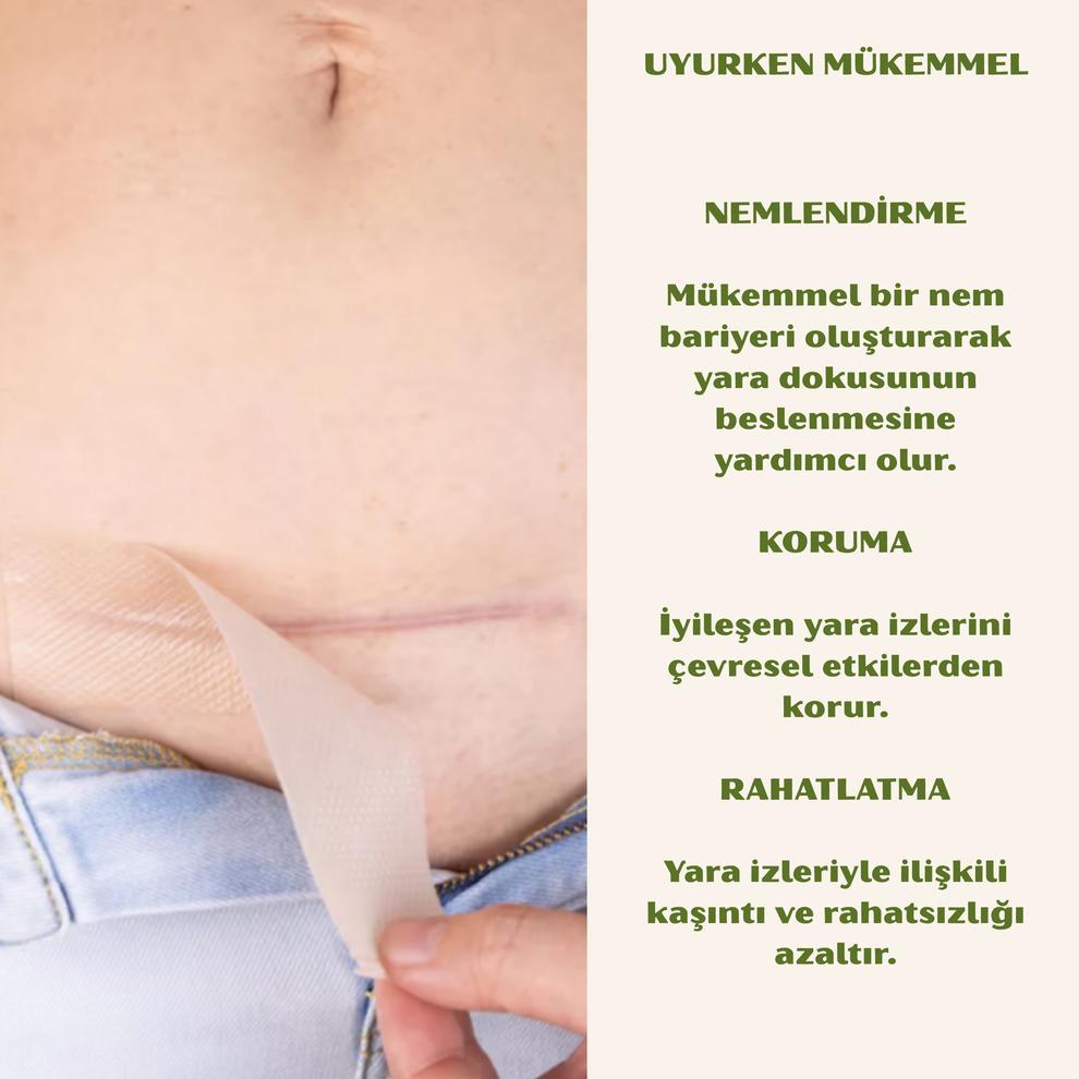 Yara İzi ve Kırışıklık Kapatıcı Silkon Bant
