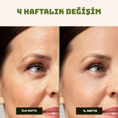 Yara İzi ve Kırışıklık Kapatıcı Silkon Bant