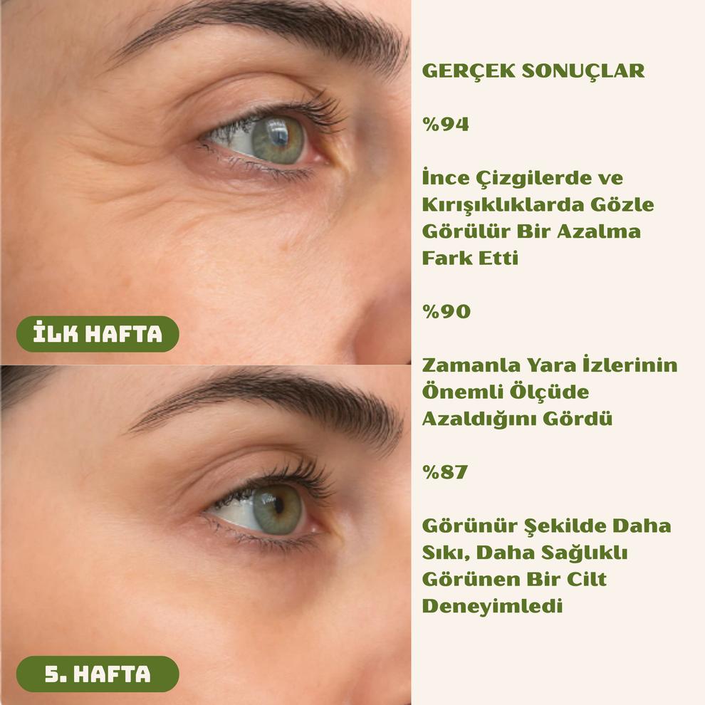 Yara İzi ve Kırışıklık Kapatıcı Silkon Bant