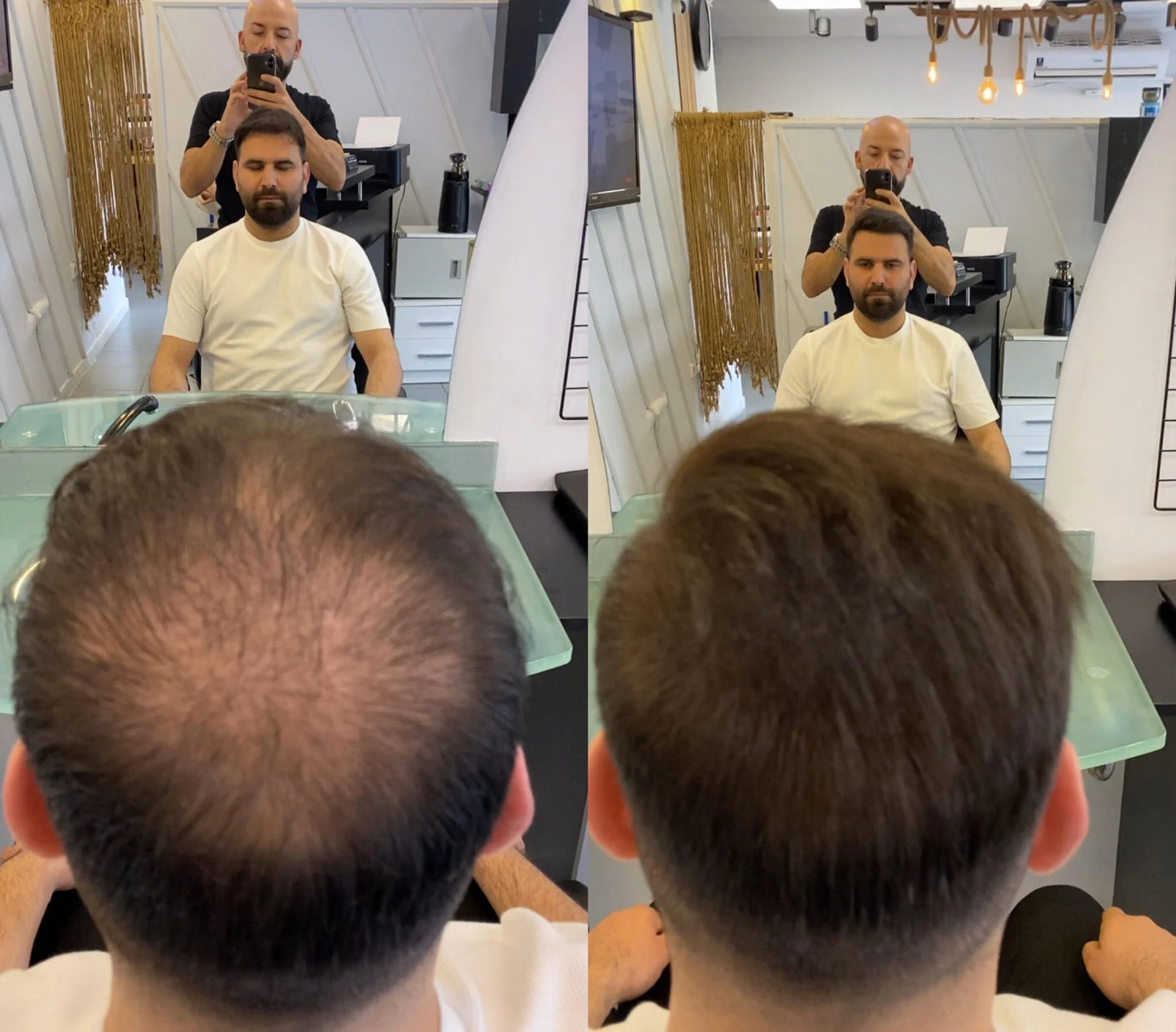Dermavol saç kapatıcı krem